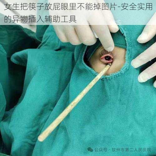 女生把筷子放屁眼里不能掉图片-安全实用的异物插入辅助工具