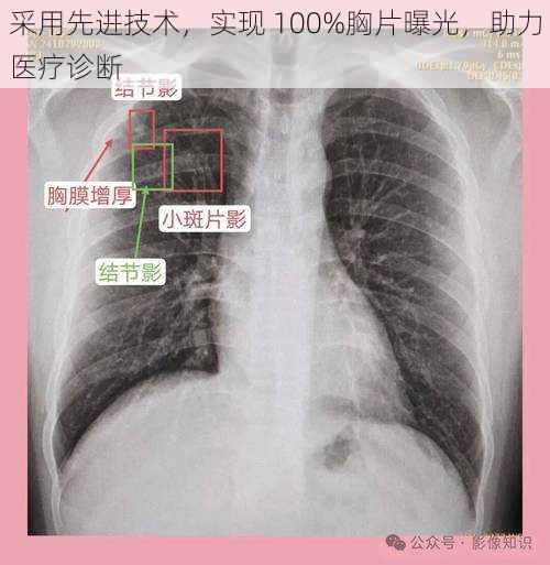 采用先进技术，实现 100%胸片曝光，助力医疗诊断