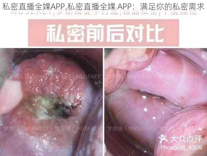 私密直播全婐APP,私密直播全婐 APP：满足你的私密需求