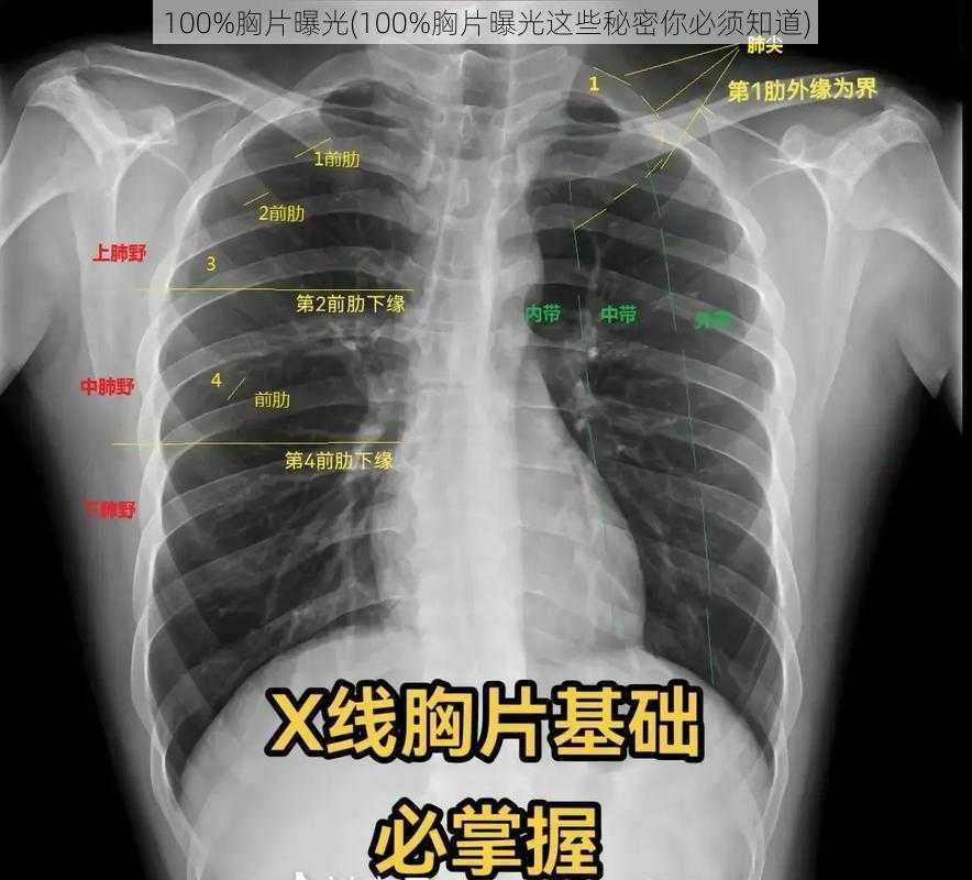 100%胸片曝光(100%胸片曝光这些秘密你必须知道)