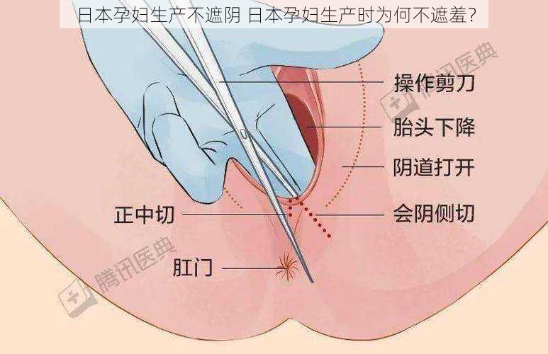 日本孕妇生产不遮阴 日本孕妇生产时为何不遮羞？