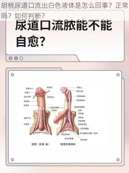 胡桃尿道口流出白色液体是怎么回事？正常吗？如何判断？